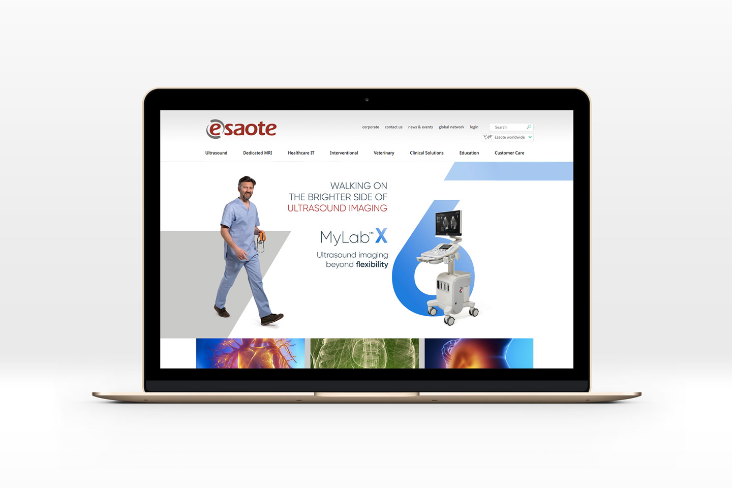 Esaote XFamily
